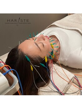鍼灸施術を受けたい