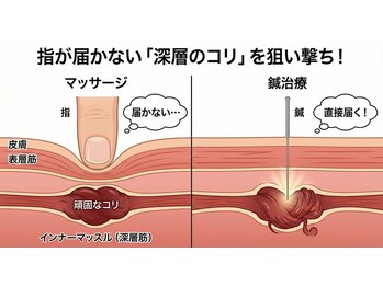 藤本整骨院 鍼灸院 長崎岩屋町本院/なぜ鍼灸が必要なのか★
