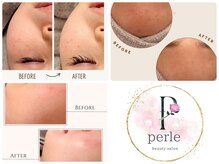 ペルル(Perle)