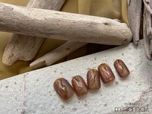 ルテ(rte)/ちぐはぐ