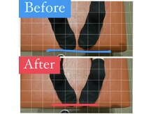 ナオル整体 宮崎院(NAORU整体)/20代女性施術事例【産後のケア】