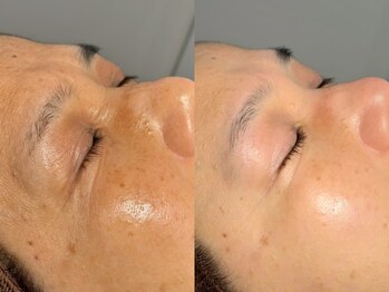 ルーナジェーナ(Luna llena)/池袋　エステ　ルーナジェーナ