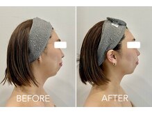 ファンシアジーク(Fanciasieg.)/韓国式美顔コルギ