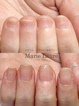 マリーロール 淀屋橋本店(Marie Laure)/自爪育成/深爪矯正/ネイルケア