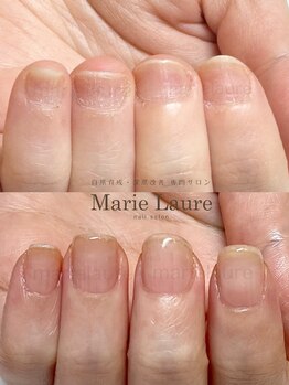 マリーロール 淀屋橋本店(Marie Laure)/自爪育成/深爪矯正/ネイルケア