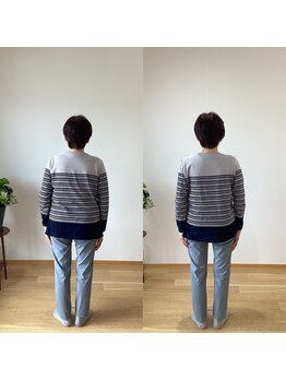 ランドル(rendre)/70代女性　脊柱弯曲