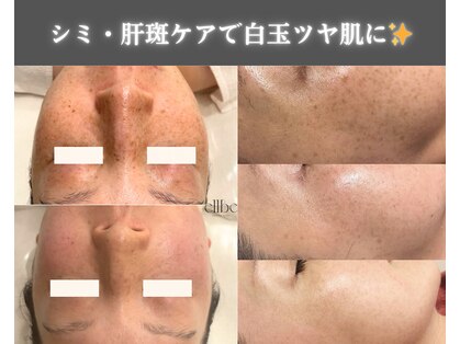 エルベ(ellbe)の写真