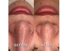 〈美肌改善、エイジング〉30代～60代に剥けないハーブ人気です◎