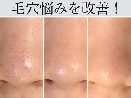 ハダイ(HADAY)の写真