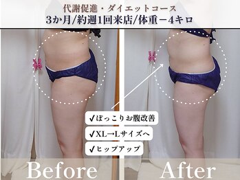 ヨサパーク ヴィオレット(YOSA PARK VIOLET)/3ヶ月で変わる