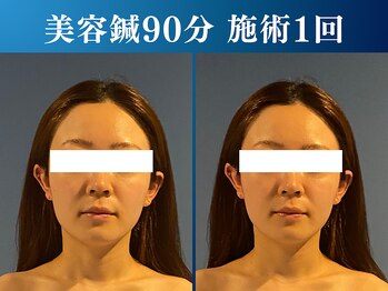 シンク 表参道(CINQ)/小顔・リフトアップ