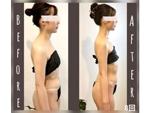 4~6月挙式&駆け込み花嫁様多数来店。至高の鎖骨・肩甲骨メソッド