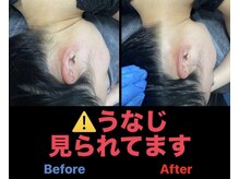 アンフィニ(Infini)/うなじって意外と見られてます！