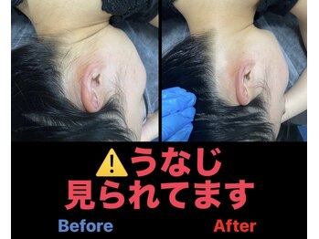 アンフィニ(Infini)/うなじって意外と見られてます!