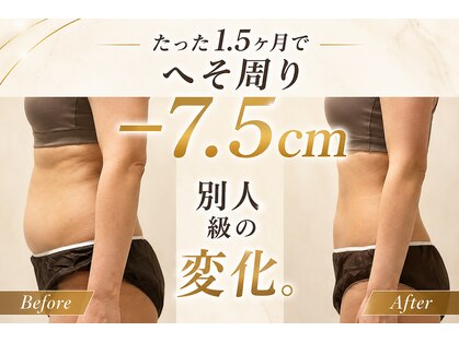 スリミア(Slimia)の写真