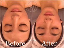 R-1ビューティーサロン 表参道/Before＆After