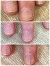 寝ながら美爪育成☆ネイルケアコース　4000円