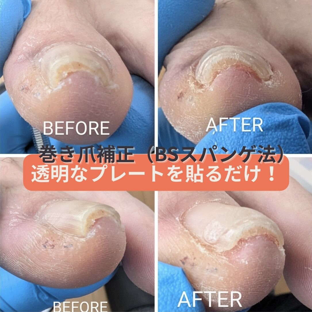 ネイルサロン使用　足角質ケア　プロヒール 新商品のお知らせ】 2024年5月16日発売のNEWプロヒールになり