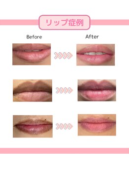 エレノア(ERENOR)/ローマピンク