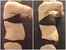 美容整体ウェリナ 名駅院/小顔矯正/骨盤矯正/美脚サロン