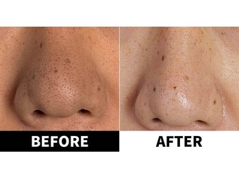 シアン(CYAN)/泡パックで美肌！