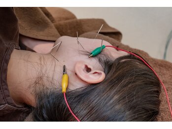 高田馬場はりきゅう院/耳の症状への鍼灸