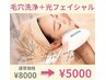 《エイジングケア》毛穴洗浄＋光フェイシャル通常￥8,000→￥5,000!!