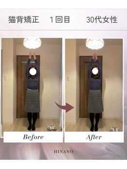 ヒナノ 矢場町店(HINANO)/猫背矯正