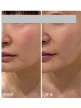 メディカルエース(MedicalAce)/全顔フォト