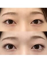 ルノン(Lunon)/ムーンロッド使用