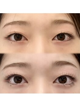 ルノン(Lunon)/ムーンロッド使用