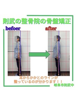 則武の整骨院の写真/《姿勢分析付き本格矯正》ストレートネック・猫背・身体の歪みを整え、不調を繰り返さない健康な身体へ！