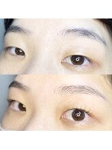 フィグ(fig)/ラッシュリフト