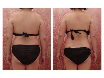 ソワンテラピー(Soin Therapy)/背中小さくクビレしっかり