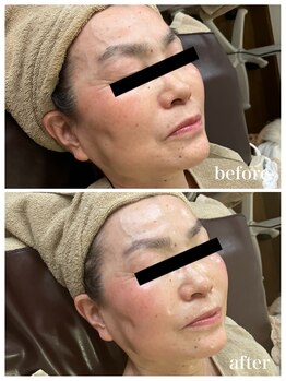 ジャスミン(Jasmin)/エステティック&シェービング