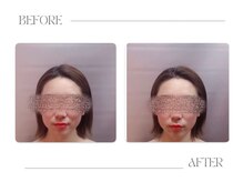 美骨鍼灸整骨院/フェイスラインとVライン