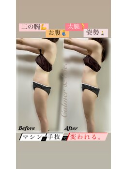 カルマーアンドビー(Calmer & Be.)/【レディース痩身】Before/After