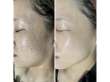 お悩みにそって最短美容メニューをご案内いたします！