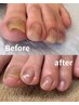 【健康爪へ育てたい方】美爪ケア　¥6600→¥5500
