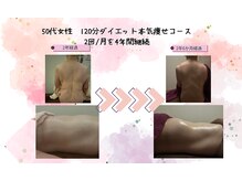 リノ(Lino)/結果重視