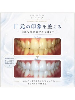 シロエス バイ アイヴィー 門前仲町(シロエス by EYEVY)の写真/初めてのホワイトニングで理想の白い歯を目指す方へ♪丁寧なケアで輝く毎日を体験しませんか？