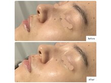 ラグ(LUXU)/毛穴レス肌◎