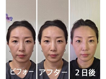 アクアナチュラ(ACQUANATURA)/夢見心地でキレイになれて最高