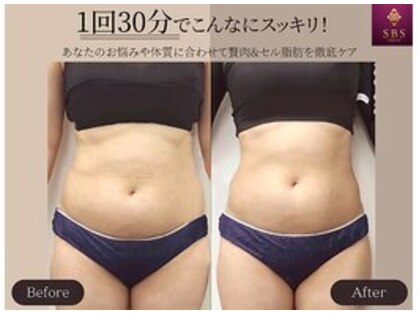 エスビーエス トウキョウ 大森店(SBS TOKYO)の写真