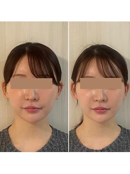 サロン ウェル(SALON WELL)/【小顔矯正/歪み/リフトアップ】