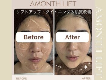 ミリュール(Millule)/アマンス1回目