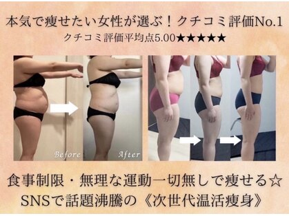 ヨサパーク タルタルーガ(YOSA PARK Tartaruga)の写真