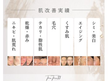 スリースリー 恵比寿(THREE THREE)/肌改善実績 掲載中/恵比寿エステ