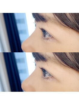 フランセス(Frances)/ラッシュリフト