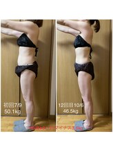 フィカス(FICUS)/スタイル維持、メンテナンスにも